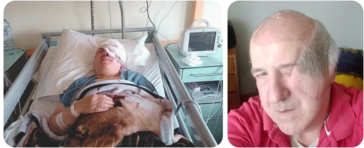 Jacek Koprowski_zbiorka