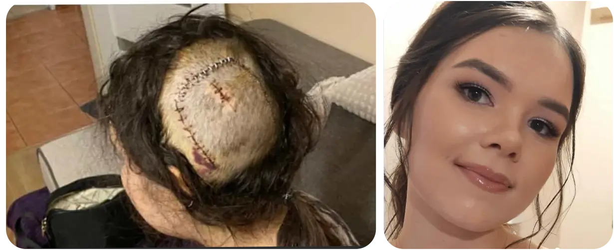 Katarzyna Podkowa - zbiorka na leczenie