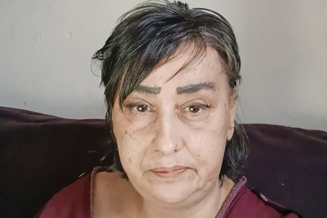 Beata Gulimow - zbiorka na leczenie