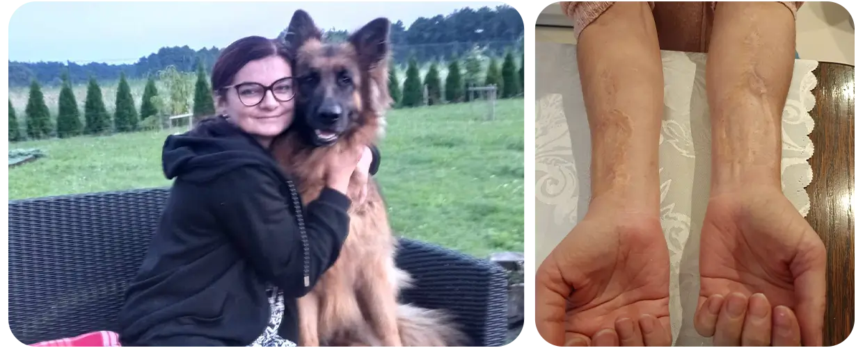 Ewa Toszewska - zbiorka na leczenie