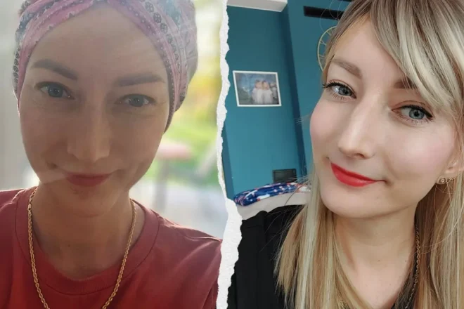 Maja Bartnicka - zbiorka na leczenie