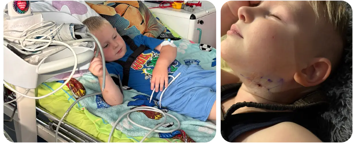 Patryk Bartyś-zbiorka na leczenie