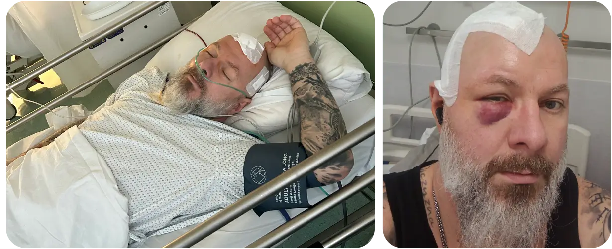 Paweł Płonczyński - zbiorka na leczenie