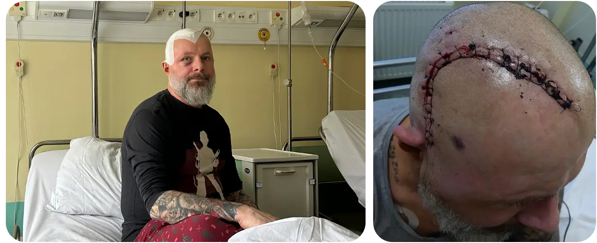 Paweł Płonczyński - zbiorka na leczenie