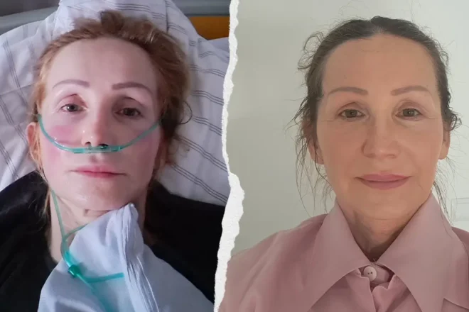 Ewa Kadyła-Stolarz - zbiorka na leczenie