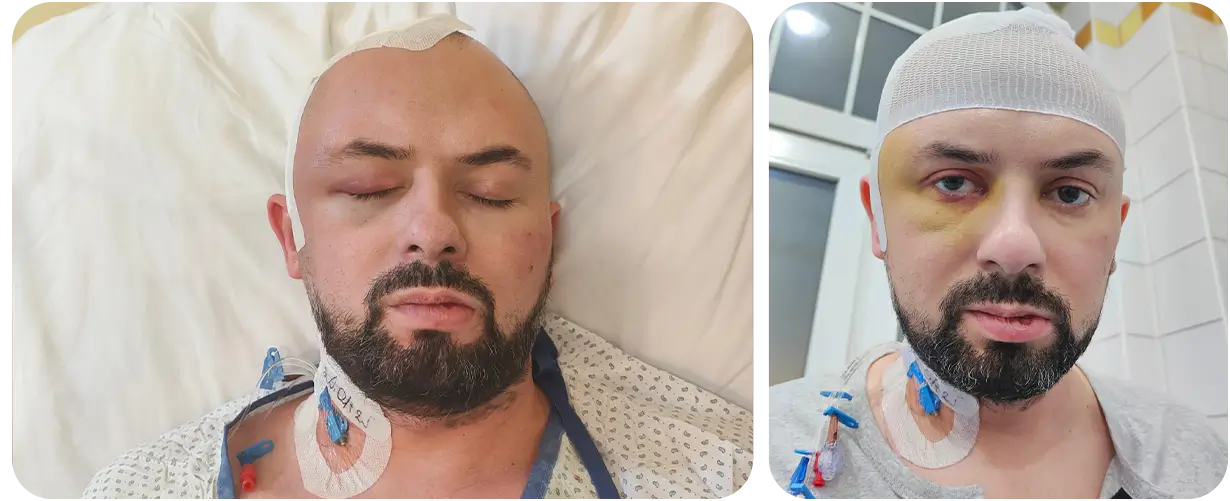 Martin Sobczak - zbiorka na leczenie